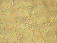 Fusarium spp.