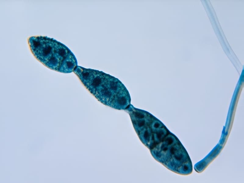 Alternaria sp. mould sample identified in the laboratory