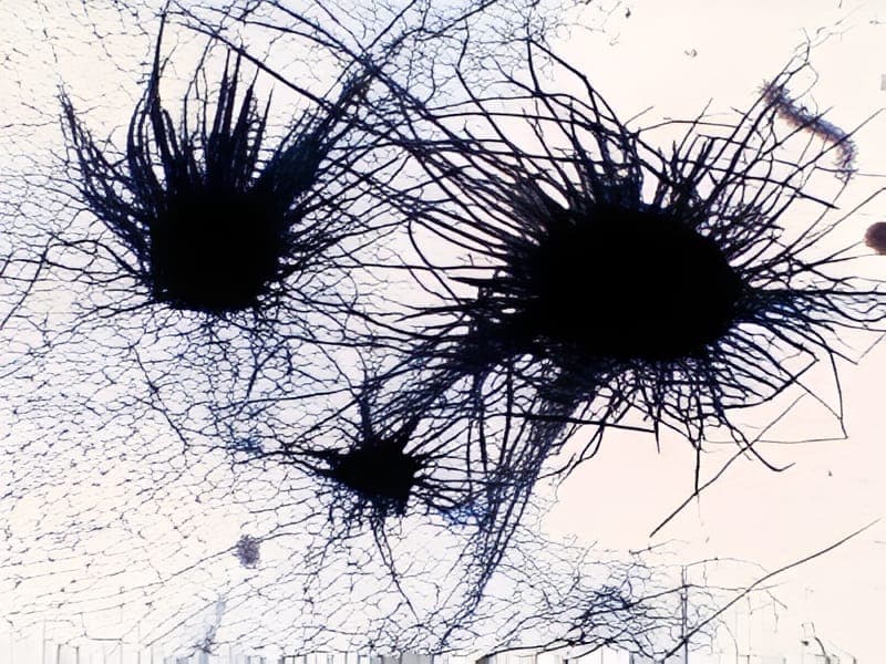 Chaetomium spp. mould sample identified in the laboratory