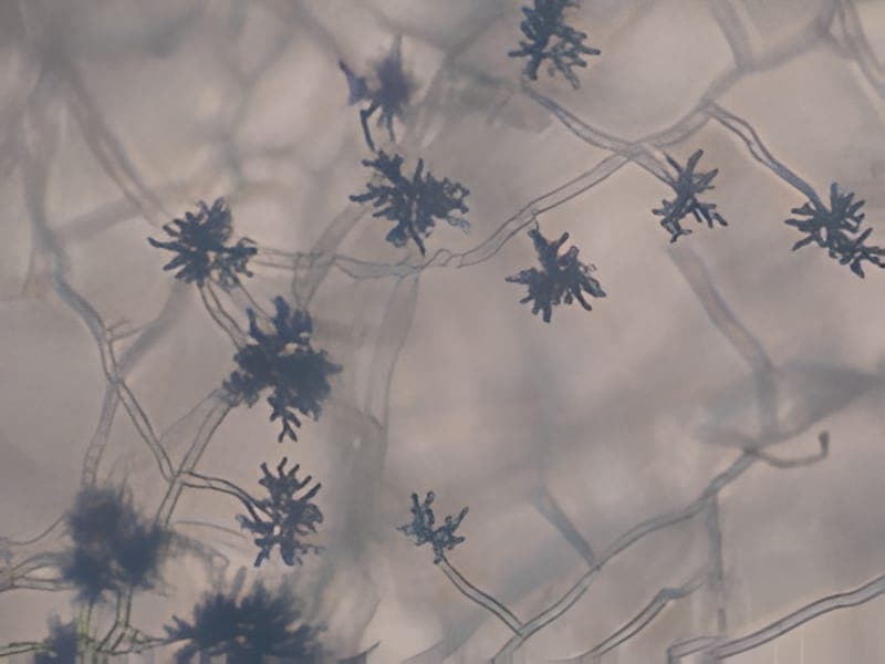 Cladosporium spp. mould sample identified in the laboratory