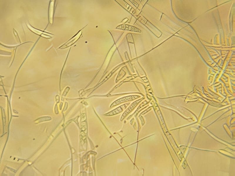 Fusarium spp. mould sample identified in the laboratory