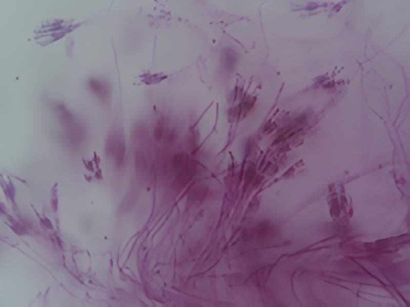 Penicillium sp. mould sample identified in the laboratory