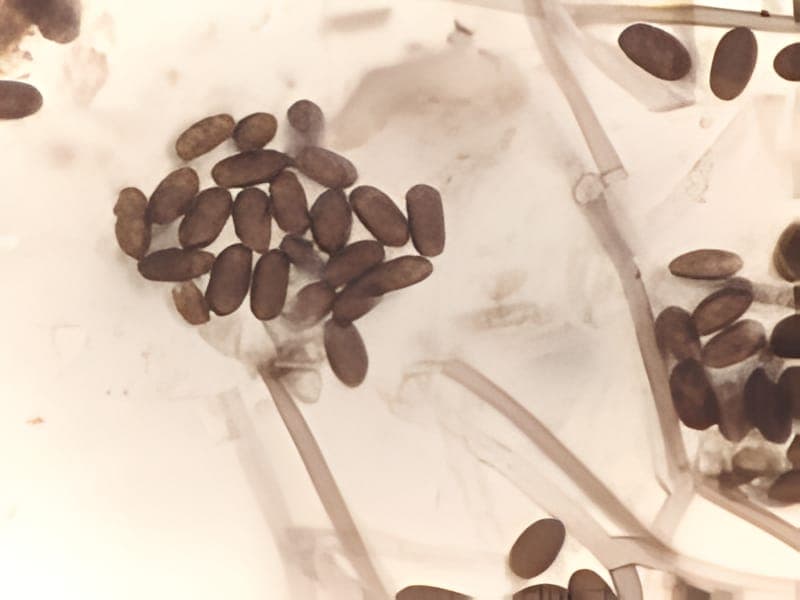Stachybotrys chartarum, the black mould, under the microscope