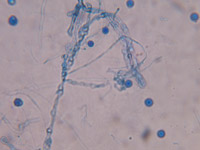 Scopulariopsis sp.